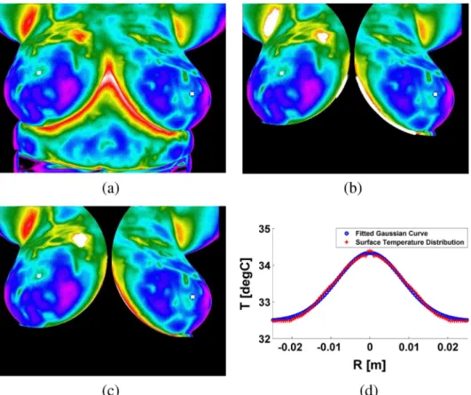 Table 1 Results from parameter estimation procedure to determine embedded tumour parameters using surface temperature distribution.