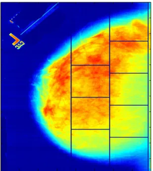 Figure 1. An example of mammogram image with five sub-images of size 1024 × 1024 considered for the analysis.