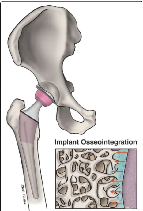 Fig. 4 Nanostructured implants may better mimic the environment ofnative bone, and stimulate implant osseointegration and surroundingosteogenesis to a greater degree than conventional implants