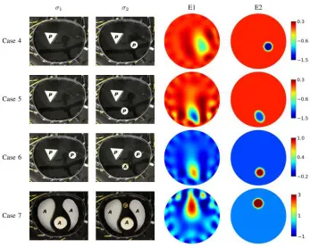 Fig. 9.Reconstructed images of the right-sided pneumothorax. (E1): estimates based on the conventional linear difference imaging