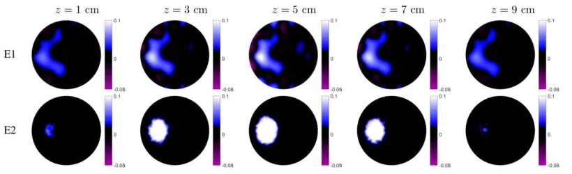 Fig. 10. Reconstructed images of the right-sided pleural effusion. (E1): estimates based on the conventional linear difference imaging