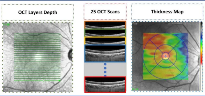 Figure 4. he schematic illustration of the proposed method, which is composed of three stages: BM segmentation, Choroid layer and thickness map generation.