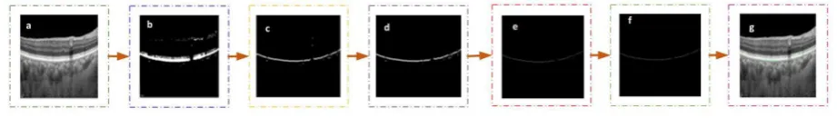 Figure 5. Bruch’s Membrane segmentation steps: In the diagram given above (a) represents the input image, (b) corresponds to the result of converting input image to binary format, (c) is the result thresholding operation, (d) represents the result of reconstruction (e) shows the result of thinning operation, and (f) step inally apply erosion and then spline itting is applied to draw the inal segmented BM area.