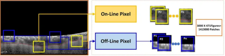 Figure 7. Patch Sampling Process: As the choroid layer was marked by a red curve, so any patch containing a pixel on the lower line (i.e