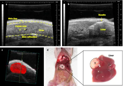 Figure 1. Representative images of ultrasound-guided intrahepatic injections and subsequent tumour