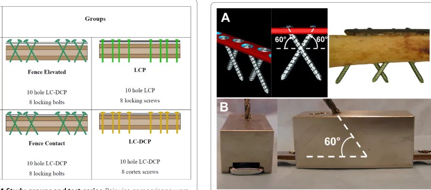 Figure 2 Fence technique. Crossed screw pattern with 60° screw an-gulation (A). A custom-made drill guide was used for standardized in-strumentation (B).