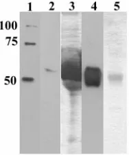 FIG. 3. Immunoprecipitation of soluble G-S added to the column; lanes 2 and 3, washes 1 and 5, respectively; lane 4, eluant 1; lane 5, eluant 2; and lane 6, six-His molecularNNadded to the column; lanes 3 and 4, washes 1 and 5, respectively; lane 5, eluant