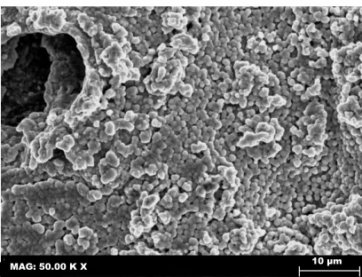 Figure 3.  SEM micrographs of Cu-Zn films obtained at two deposition potentials (Ed): (a) -1.55 V and (b) -1.30 V