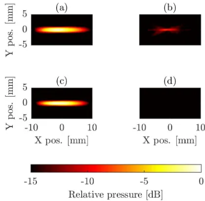 Fig. 7.Examples of signals from the passive cavitation detector duringlesioning. Gray line: PCD waveform during thermal-only lesioning with thelinear ampliﬁer