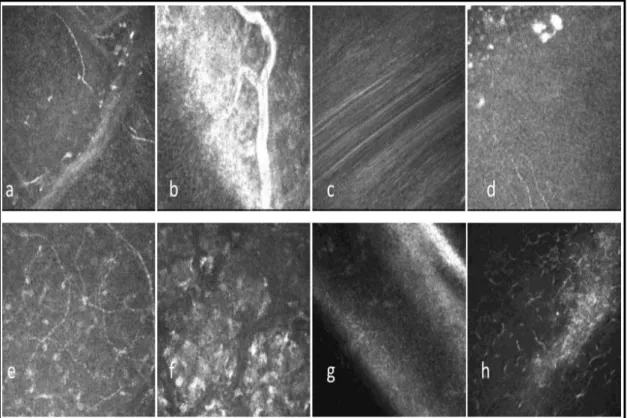 Figure 1.5: Representative examples of CCM images with different types of   noise and artifacts: (a) Corneal tissue deformation, (b) Illumination artifacts and 