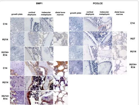 Figure 4 Changes in the pattern of expression of genes involved in ECM deposition (BMP1, PCOLCE 1, 2) induced by HU, and their revers-ibility