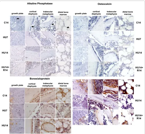 Figure 2 Changes in the pattern of expression of genes involved in the osteogenic progression (AP, OC and BSP) induced by HU, and their reversibility