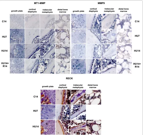 Figure 3 Changes in the pattern of expression of genes involved in ECM proteolysis (MMP-9, MT1-MMP, RECK) induced by HU, and their reversibility
