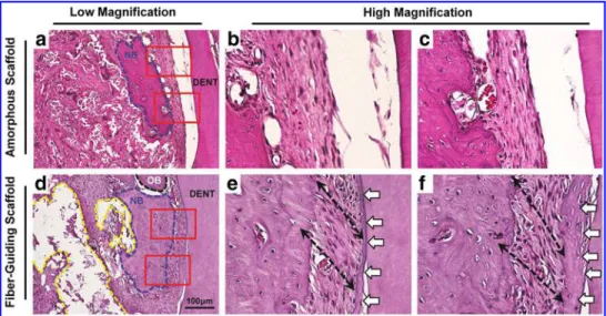 FIG. 4. SEM images. The amorphous, random-porous scaffold (a, b) displays limited—no connective or  fi-brous tissue within the PDL interface, while the  fiber-guiding scaffold (c, d) showed that fibrous tissues were densely generated in the PDL region and 