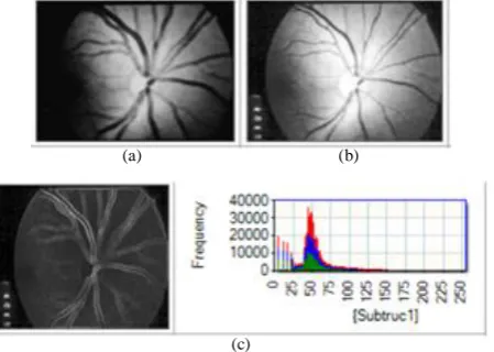 Fig. 5. The results (image and its histogram) of the first stage in the retina based key generation system, (a) The original loaded image, (b) Enhanced image with equalizing individual color method, (c) The grayscale image, (d) The grayscale image histogra