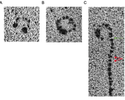 Figure 1.2. Electron micrographs of LDL and Lp(a). 