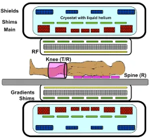 Figure 1.2-1: A cross-section of a modern, cylindrical bore superconducting 