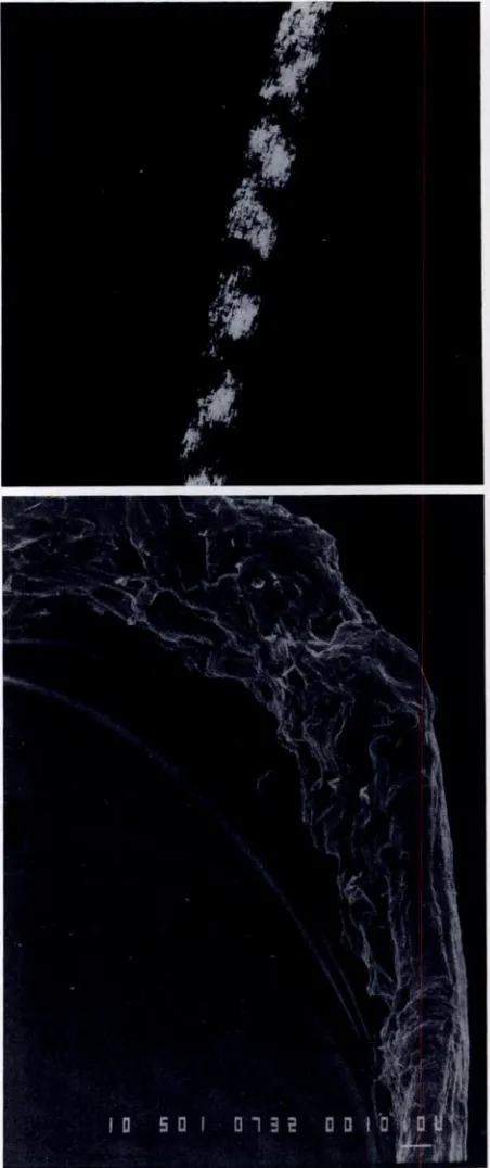 Fig 3.Scalpbandstionhair.Top,Alternatingbrightanddarkseenwithpolarizedmicroscopy.Bottom,Cavita-ofcuticlewithamorphousdebris(x500).