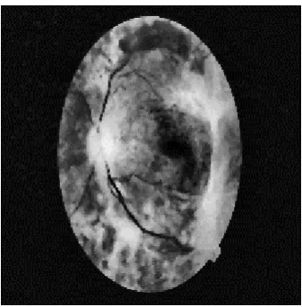 Figure 1: fundus image database set  