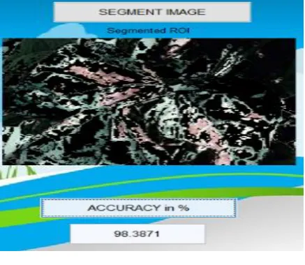 Fig. 5: segmentation of image 