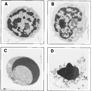 FIG. 5. Light scatter and AO-EB ﬂuorescence plots of PBMC undergoingspontaneous and activation-induced apoptosis