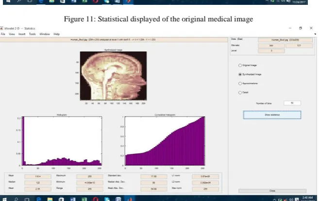 Figure 11: Statistical displayed of the original medical image 