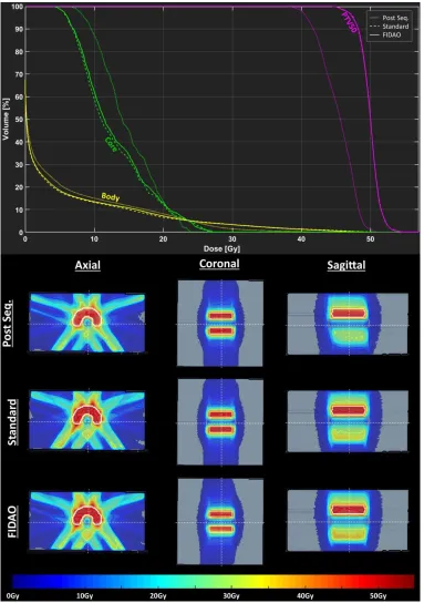 Figure 3.2: Dose-volume histograms (upper) and sample dose-distributions (lower) of 