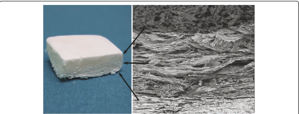 Figure 1 Three-gradient, multi-layer scaffold that mimics the articular osteochondral compartment, reproducing both molecularly andmorphologically cartilage and the subchondral bone layer.