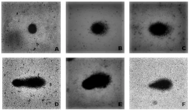 Figure 1.  “Comets” images to classify damage according to “tail” size: A = class zero/ undamaged;    B = class 1; C = class 2; D = class 3; E = class 4; F = apoptosis/cell death [21]