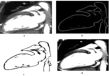 Fig . 12  a) Optimize light intensity .  b) Select the image spatial range.   c) Remove border pixels