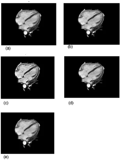 Fig . 1  Image enhancement results with different conversion methods (a) Split image, (b) FFT , (c) LOG (d) Hadamard 's transformation (e) DCT