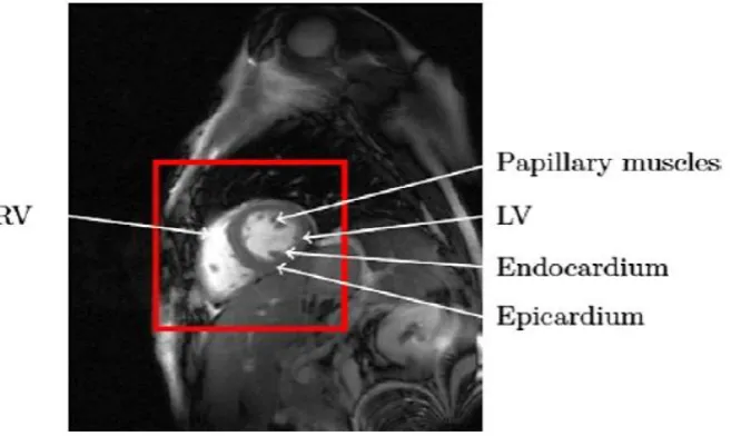 Fig. 2   Heart MR image and full range of ROI to identify the heart 