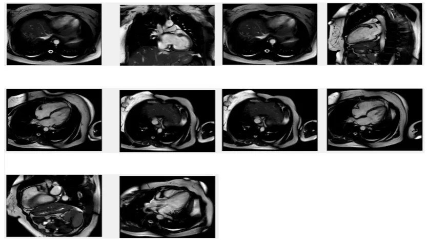 Figure 3  is The implementation of this command (the patient's MRI images). 