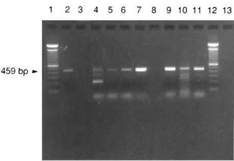 FIG. 1. PCR products from H. pylorimuridarumstomach mucosal tissue and representing DNA from 0.2 (lane 11), 2 (lane 12), 20(lane 13), 200 (lane 14), and 2,000 (lane 15) cells; lanes 17 to 19, PCR productsfrom 2,000 cells of pure culture oflanes 3 to 7, PCR