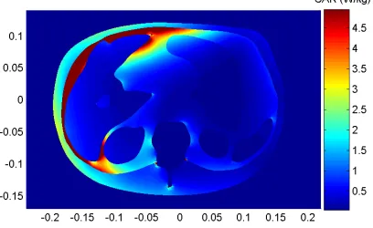 Figure 1. Repartition of the speciﬁc absorption rate (SAR) inside thebody when it is illuminated by four incoming waves