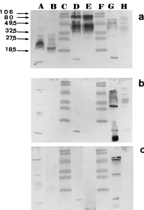 TABLE 2. Comparison of anti-Brucella IgG titers and anti-Aﬁpiaclevelandensis IgG titers among 32 sera of 22 patientswith conﬁrmed past or active brucellosis