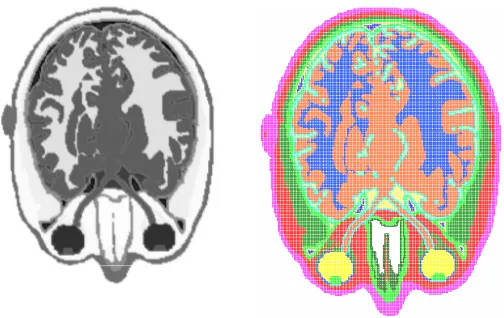 Figure 1. An MRI image (left) and the corresponding FDTD grid(right) for a horizontal slice.