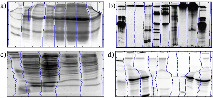 Figure 7. Examples of correct lane detections in four gel images with problematic lane boundaries because lanes overlap each other
