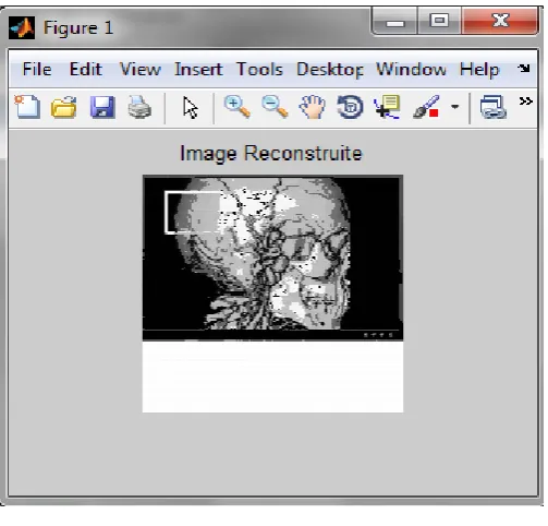 Fig 4 shows the original image of the test 2. This image is compressed using dwt technique