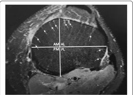 Fig. 2 Example of quadrant division and scoring. The same left knee5, 0, 2, and 3 for anteromedial, posteromedial, posterolateral, andlevel 3 MRI slice seen in Fig