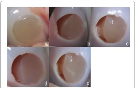 Figure 4 CaReS®-1S surface at 0 (a), 2000 (b), 4000 (c), 6000(d), and 8000 (e) motion cycles.