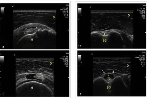 Table 2 Sonographic findings in diabetics and control subjects