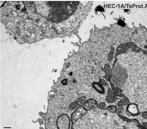 TABLE 2. Virus particles produced in HEC-1A and BHK-21 cellsinfected with TsProt.A