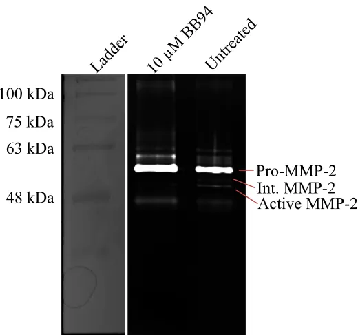 Fig. E.1. Zymography for BB94 treatment. 