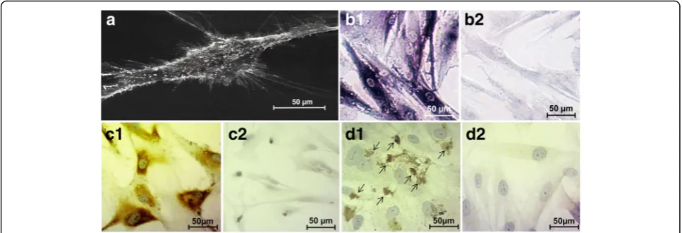Fig. 1 Morphological and immunocytochemical characteristics of osteoblasts from a primary culture.type-1 (the architecture of a flattened fibroblast-like osteoblast with several fiber-like extensions