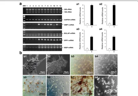 Fig. 2 Analysis of osteoblast mineralization.b7micrographs showing irregular- and rough cell surface after 15 days of cultivation in OSC-supplemented medium ( a Agarose gel electropherograms showing the RT-PCR banding patterns of DMP1-, BGLAP-, SPP1- andIB
