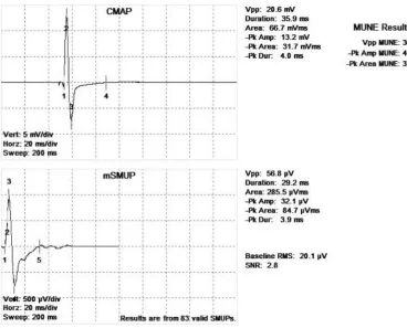 Figure 6: Compound muscle action potential (CMAP) and motor unit 