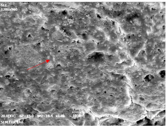 Figure 4: SEM images at 90 days in study group 