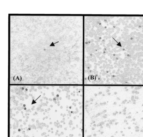 FIG. 2. Screening of the lambda ZAP Phage expression library of Ecorestricted genomic DNA ofindividuals with active TB