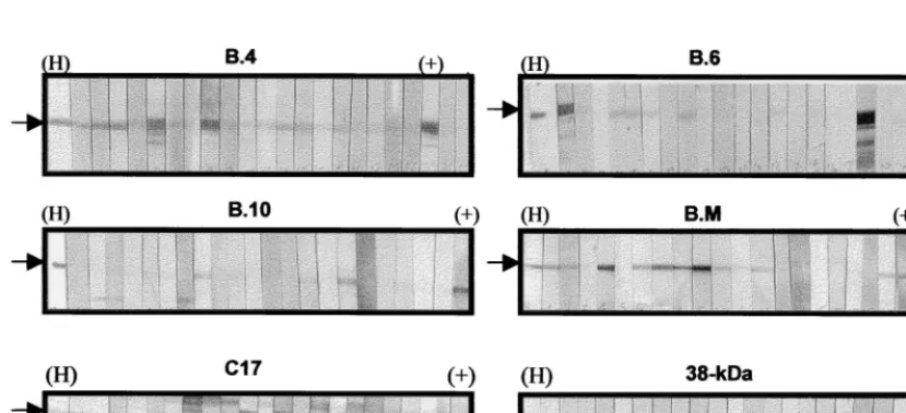 FIG. 4. Recombinant M. tuberculosisa Western blot of a duplicate gel which was probed with anti-RGS His antibody followed by detection with alkaline phosphatase-conjugated goat anti-mouse Ig andNBT-BCIP substrate (B)